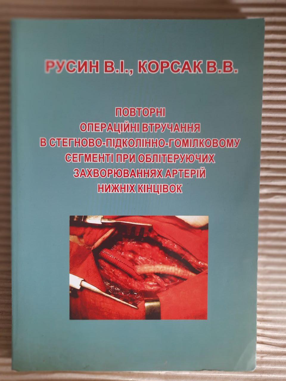 Повторні операційні втручання в стегново-підколінно-гомілковому сегменті при облітеруючих захворюваннях артерій нижніх кінцівок.