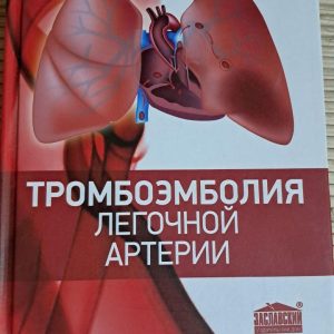 Тромбоемболія легеневої артерії. Ф. З. Глумчера. Київ 2016