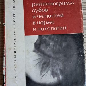 Атлас рентгенограм зубів та щелеп у нормі та патології. І. А. Шахтар. Ю. І. Воробйов. 1968