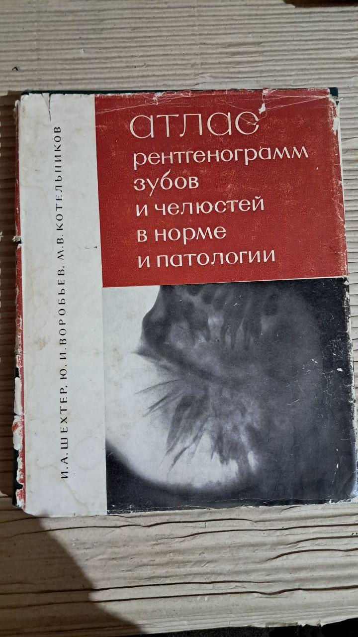 Атлас рентгенограм зубів та щелеп у нормі та патології. І. А. Шахтар. Ю. І. Воробйов. 1968